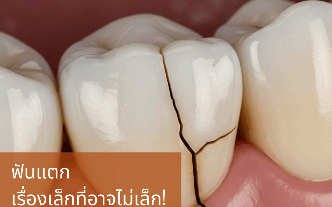 ⚡ ฟันแตก…เรื่องเล็กที่อาจไม่เล็ก! 🦷